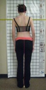 girl having posture assessed
