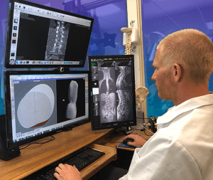 Scoliosis Care Centers 3D Brace fitting design process