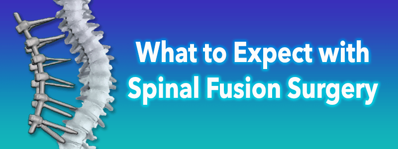 what-to-expect-with-spinal-fusion-surgery-scoliosis-care-centers