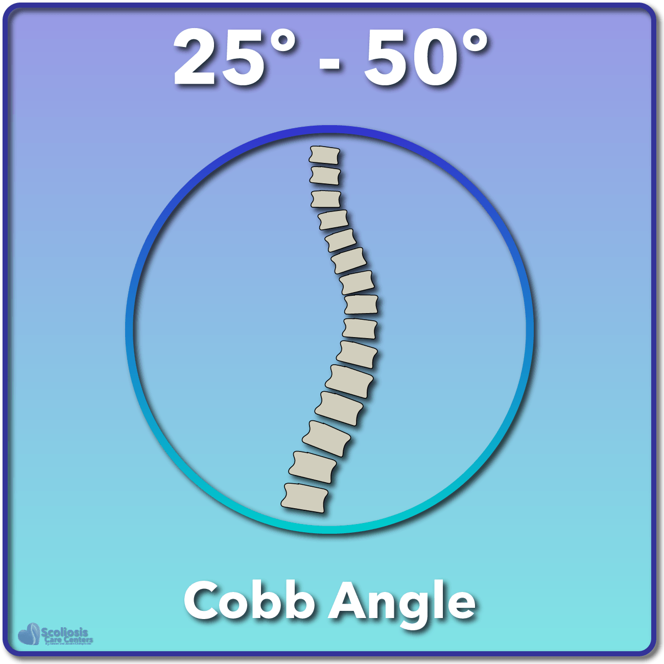 25-50 Degree Cobb Angle Scoliosis Category