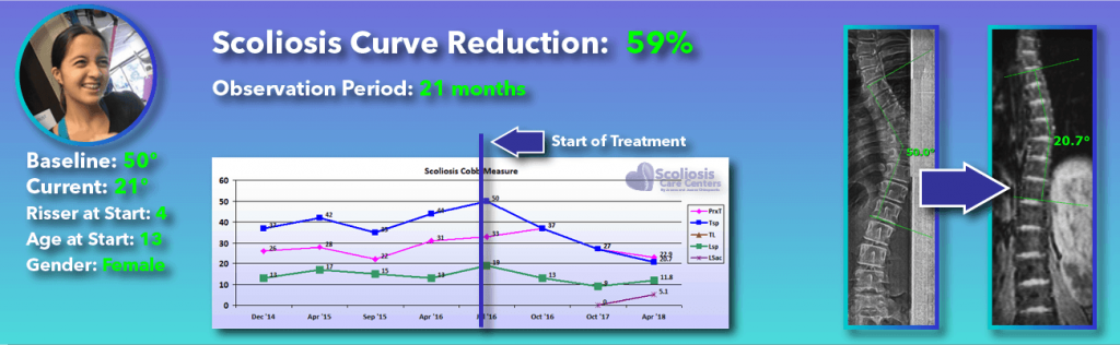 59 percent scoliosis reduction achieved through non-surgical methods