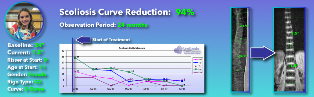 94 percent scoliosis reduction achieved through non-surgical methods