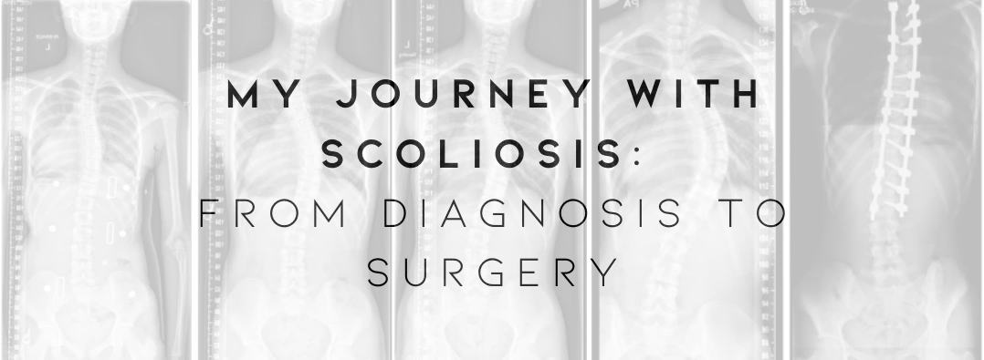 Scoliosis Journey of Starr