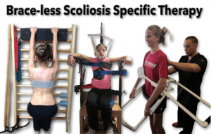 Braceless Scoliosis Specific Therapy - Traction Chair, Schroth, Exercises
