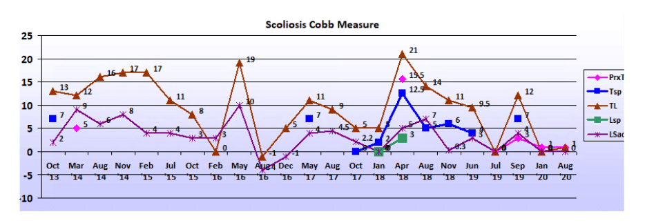 Graph showing scoliosis curve progression from start to end, detailing degrees of curve reduction.