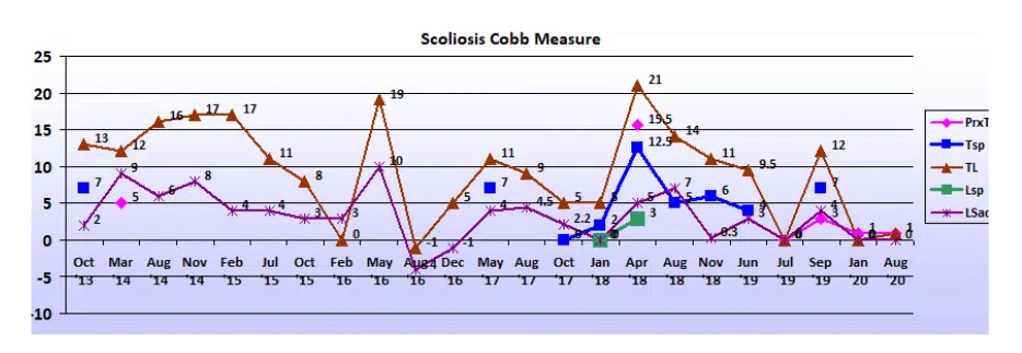 Graph showing scoliosis curve progression from start to end, detailing degrees of curve reduction.