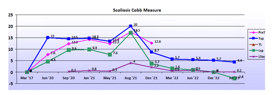 Graph showing scoliosis curve progression from start to end, detailing degrees of curve reduction.