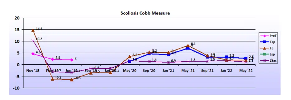 Graph showing scoliosis curve progression from start to end, detailing degrees of curve reduction.