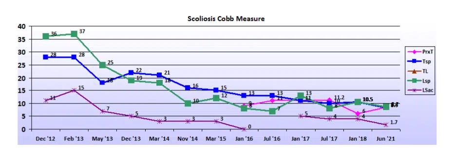 Graph showing scoliosis curve progression from start to end, detailing degrees of curve reduction.