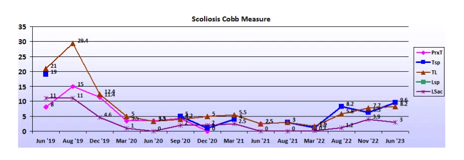 Graph showing scoliosis curve progression from start to end, detailing degrees of curve reduction.