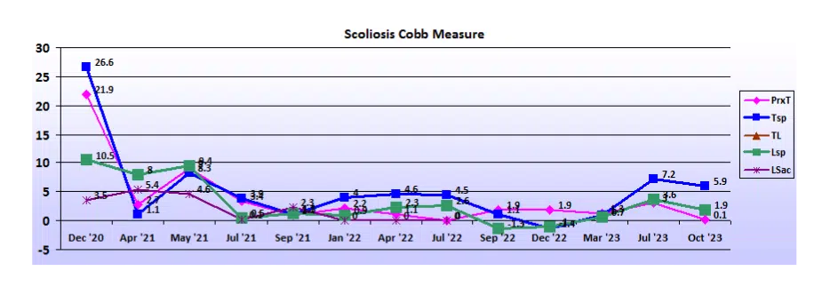 Graph showing scoliosis curve progression from start to end, detailing degrees of curve reduction.