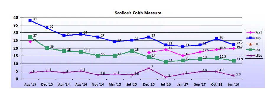 Graph showing scoliosis curve progression from start to end, detailing degrees of curve reduction.