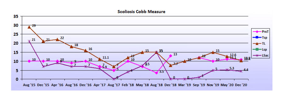 Graph showing scoliosis curve progression from start to end, detailing degrees of curve reduction.