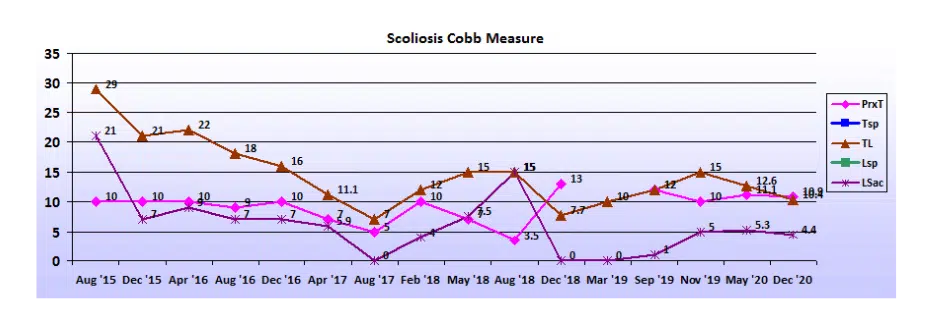 Graph showing scoliosis curve progression from start to end, detailing degrees of curve reduction.