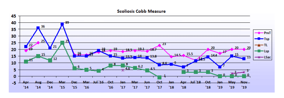 Graph showing scoliosis curve progression from start to end, detailing degrees of curve reduction.