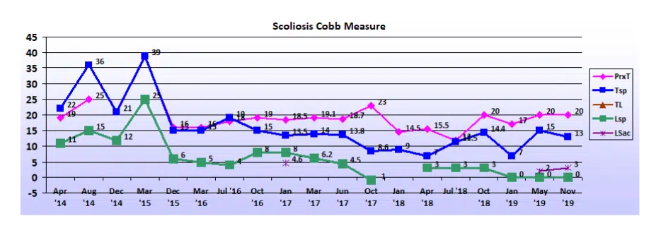 Graph showing scoliosis curve progression from start to end, detailing degrees of curve reduction.