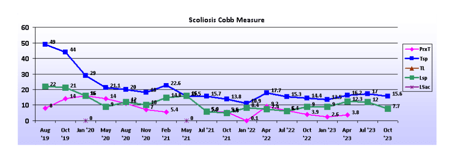 Graph showing scoliosis curve progression from start to end, detailing degrees of curve reduction.