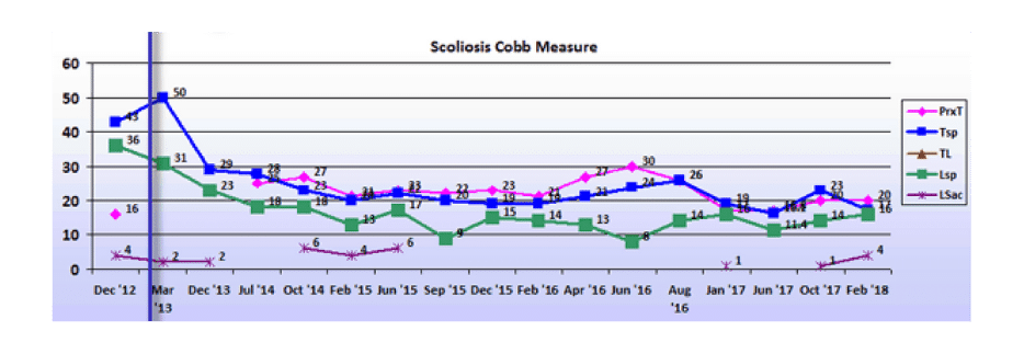 Graph showing scoliosis curve progression from start to end, detailing degrees of curve reduction.