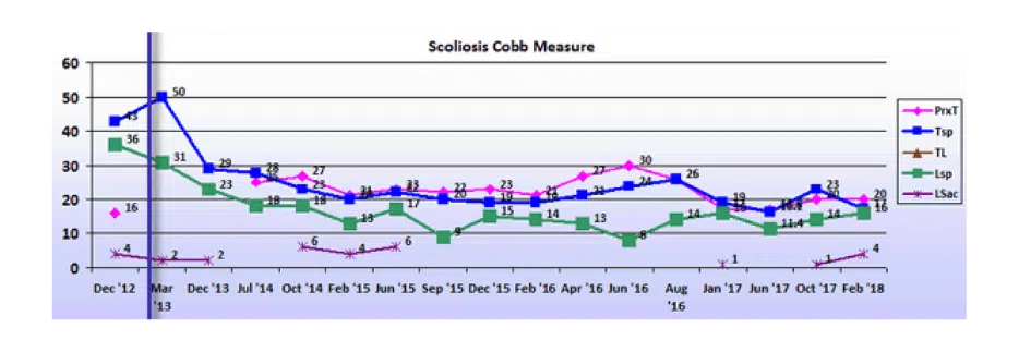 Graph showing scoliosis curve progression from start to end, detailing degrees of curve reduction.