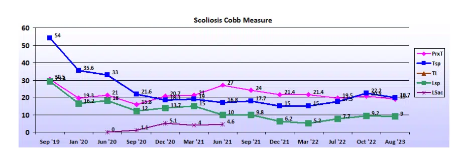 Graph showing scoliosis curve progression from start to end, detailing degrees of curve reduction.