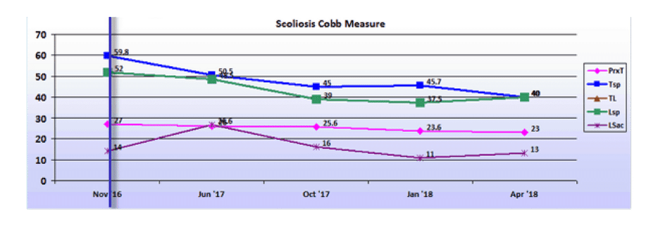 Graph showing scoliosis curve progression from start to end, detailing degrees of curve reduction.