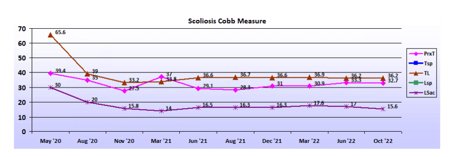 Graph showing scoliosis curve progression from start to end, detailing degrees of curve reduction.