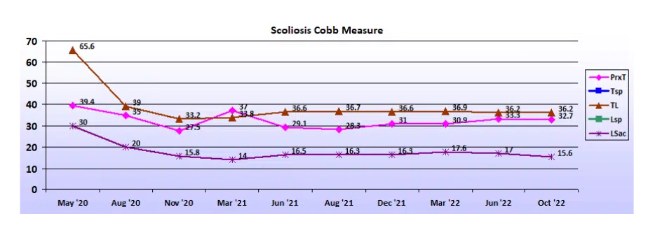 Graph showing scoliosis curve progression from start to end, detailing degrees of curve reduction.