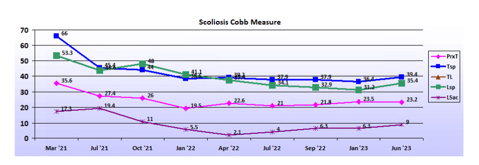 Graph showing scoliosis curve progression from start to end, detailing degrees of curve reduction.