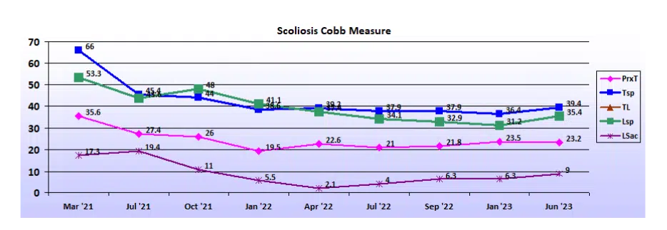 Graph showing scoliosis curve progression from start to end, detailing degrees of curve reduction.