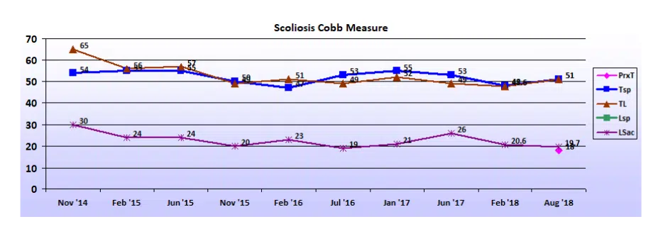 Graph showing scoliosis curve progression from start to end, detailing degrees of curve reduction.