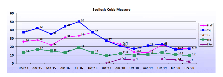 Graph showing scoliosis curve progression from start to end, detailing degrees of curve reduction.