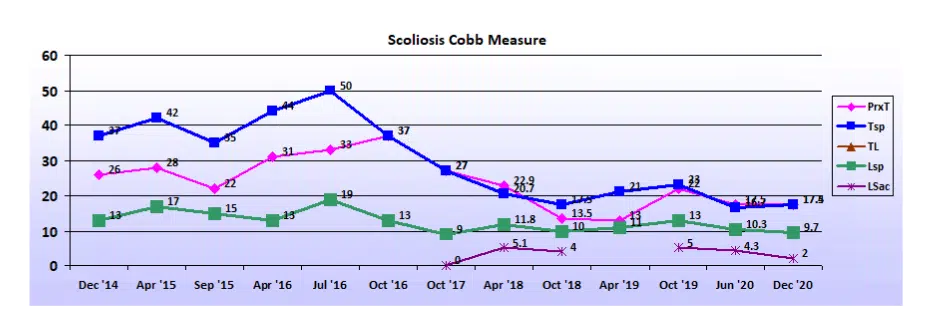 Graph showing scoliosis curve progression from start to end, detailing degrees of curve reduction.