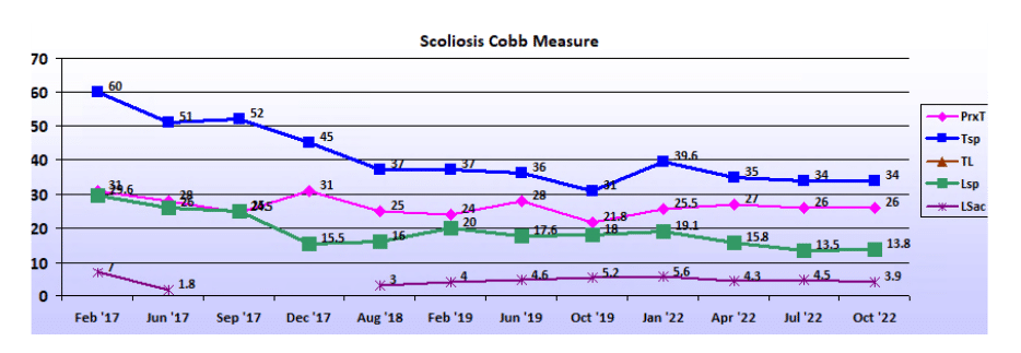 Graph showing scoliosis curve progression from start to end, detailing degrees of curve reduction.