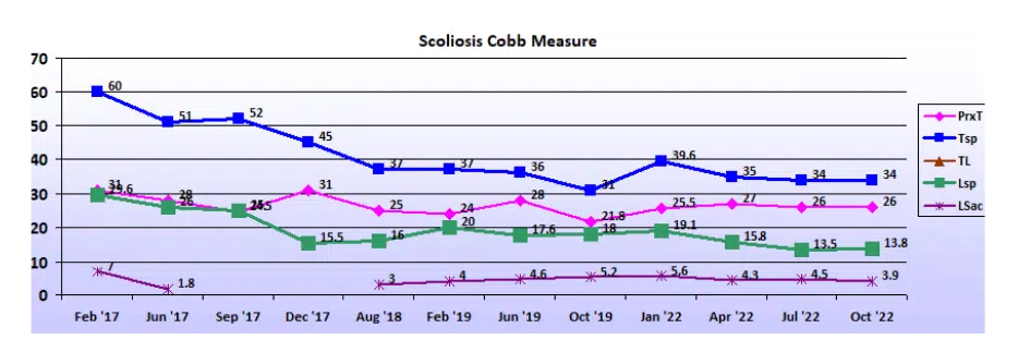 Graph showing scoliosis curve progression from start to end, detailing degrees of curve reduction.