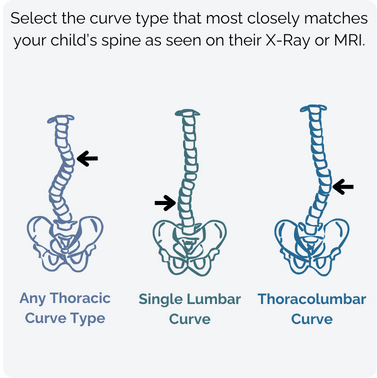 Curve Type Example