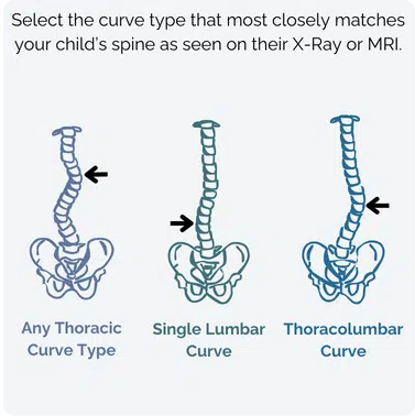 Curve Type Example