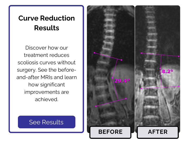 Scoliosis treatment Results by Curve Size