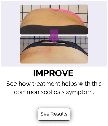 Scoliosis Treatment Results for nonsurgical treatment