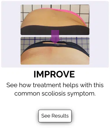 Scoliosis Treatment Results for nonsurgical treatment