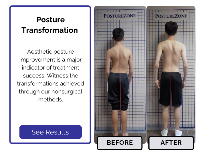 Scoliosis treatment results by posture transformations of back.