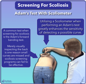 SureScreen scoliosis screening also using Adam's test
