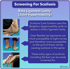 SureScreen looks for early warning signs of scoliosis during screening