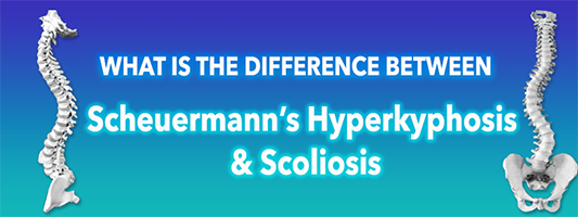 What s The Difference Between Scoliosis And Kyphosis 