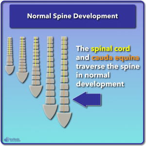 Example of normal spine development without nerve tension