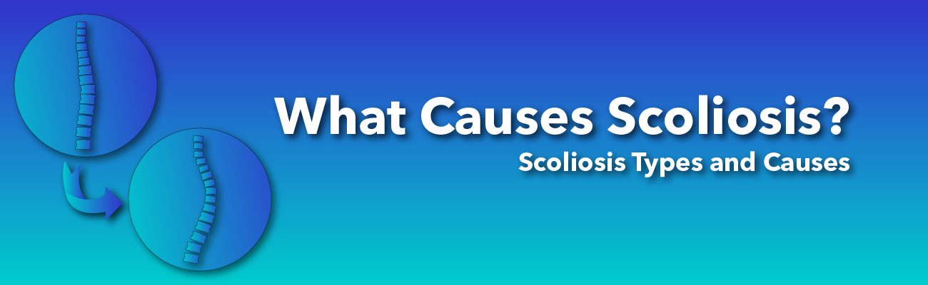 How scoliosis is caused: Types and causes of scoliosis