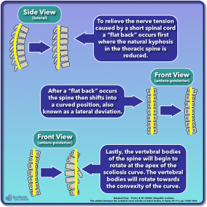 Diagram showing progressive adaptations of the spine in response to nerve tension