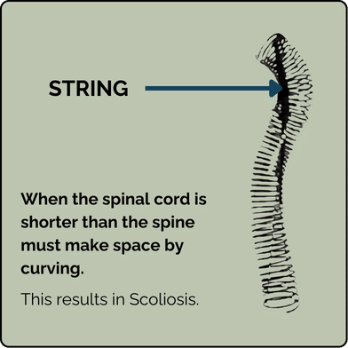 Nerve Tension Model 1