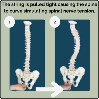 Nerve Tension Model 2