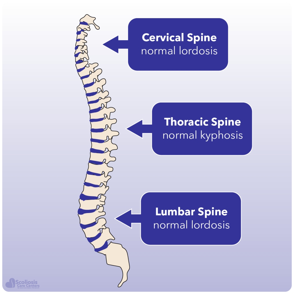 Kyphosis and Hyperkyphosis - What it is, how it happens, and what to do