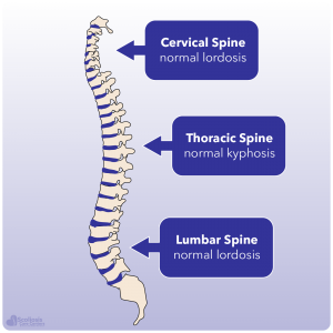 Normal spine showing locations of naturally occurring lordosis and kyphosis